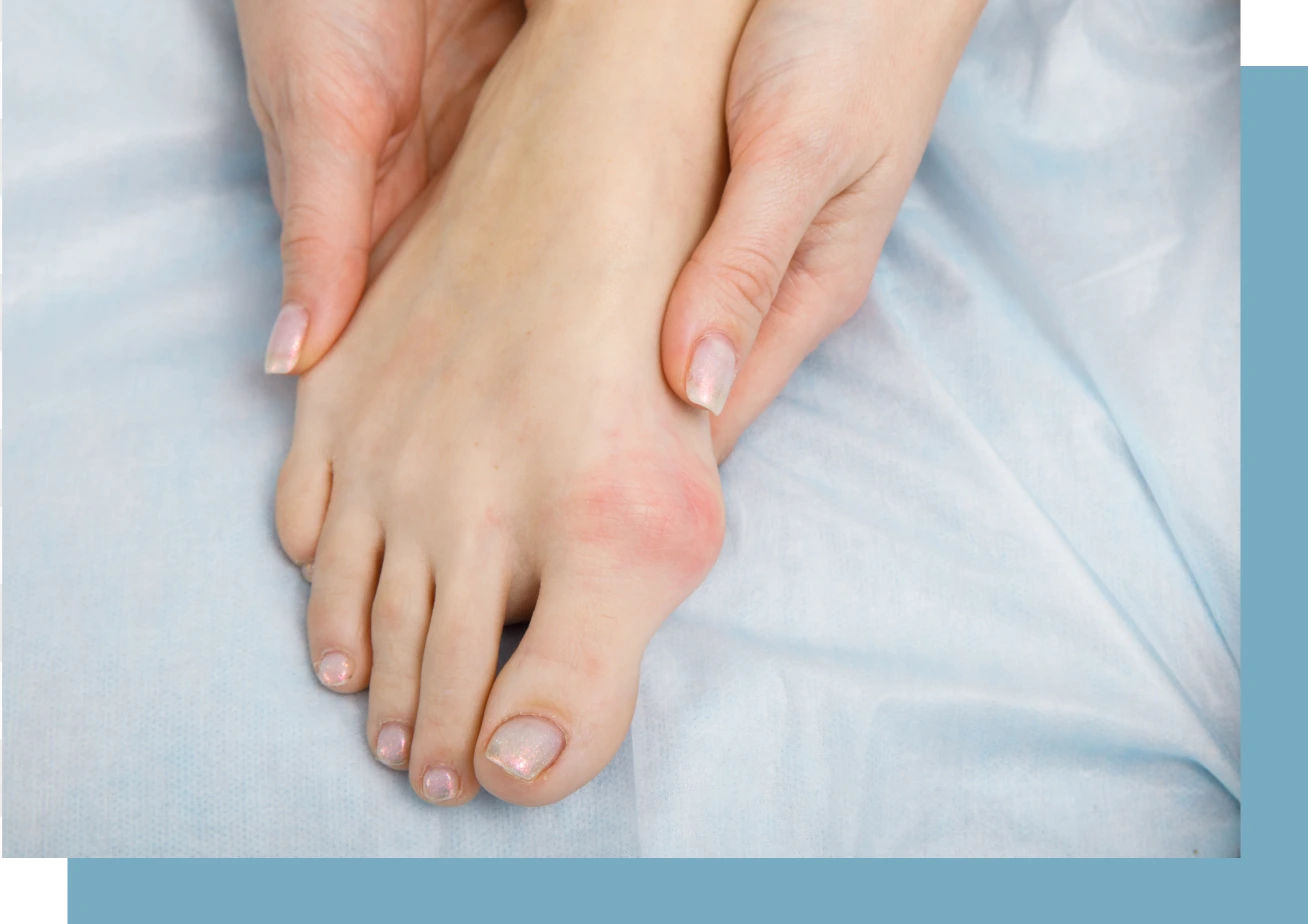 Big Toe Arthritis